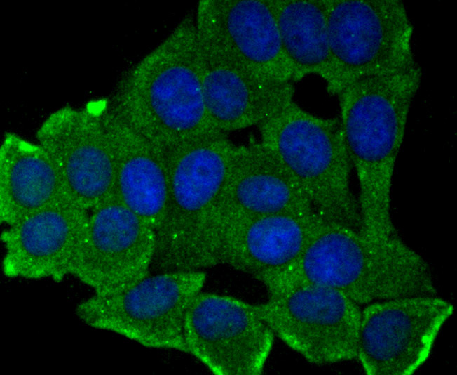 IF(ICC) staining with MMP17 (8C8) Monoclonal Antibody (bsm-54233R) at 1:100 in MCF-7 cells (green). The nuclear counterstain is DAPI (blue). Cells were fixed in paraformaldehyde, permeabilized with 0.25% Triton X100/PBS.
