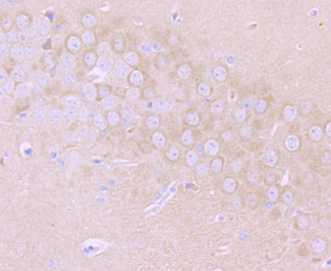 Paraformaldehyde-fixed and paraffin-embedded Mouse Brain tissue incubated with MMP17 (8C8) Monoclonal Antibody (bsm-54233R) at 1:100, overnight at 4°C, followed by a conjugated secondary antibody and DAB staining. Counterstained with hematoxylin.