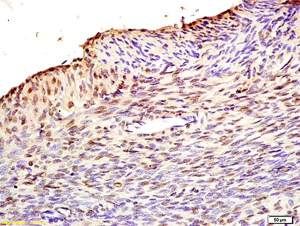 Formalin-fixed and paraffin embedded rat uterus labeled with Anti MAFbx/Fbx32 Polyclonal Antibody, Unconjugated (bs2591R) at 1:200 followed by conjugation to the secondary antibody and DAB staining.