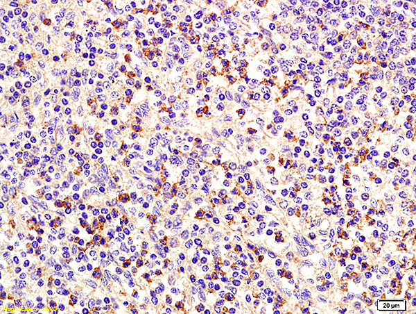 Formalin-fixed and paraffin embedded human spleen labeled with Anti CD75 Polyclonal Antibody, Unconjugated (bs-3793R) at 1:200 followed by conjugation to the secondary antibody and DAB staining.