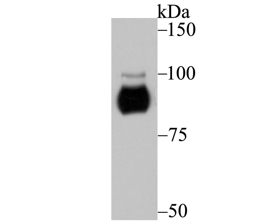 Lane 1: A549 Cells; Probed with PRKD2 (4C4) Monoclonal Antibody (bsm-54236R) at 1:500 overnight at 4°C followed by a conjugated secondary antibody for 60 minutes at 37°C. Lane 1: A549 Cells; Probed with PRKD2 (4C4) Monoclonal Antibody (bsm-54236R) at 1:500 overnight at 4°C followed by a conjugated secondary antibody for 60 minutes at 37°C.