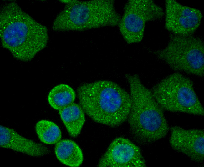 IF(ICC) staining with PRKD2 (4C4) Monoclonal Antibody (bsm-54236R) at 1:100 in A549 cells (green). The nuclear counterstain is DAPI (blue). Cells were fixed in paraformaldehyde, permeabilized with 0.25% Triton X100/PBS.
