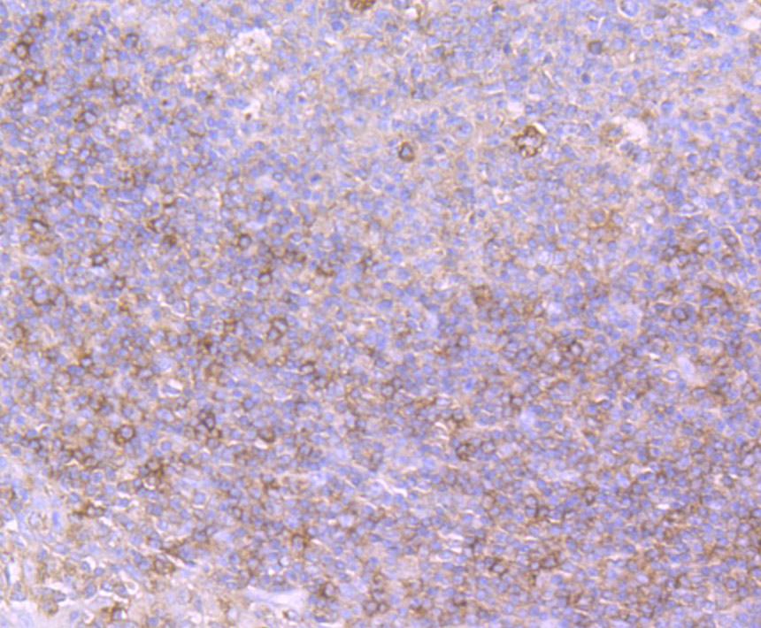 Paraformaldehyde-fixed and paraffin-embedded Human Tonsil tissue incubated with PRKD2 (4C4) Monoclonal Antibody (bsm-54236R) at 1:100, overnight at 4°C, followed by a conjugated secondary antibody and DAB staining. Counterstained with hematoxylin.