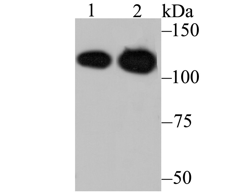 Lane 1: Daudi Cells; Lane 2: Mouse Brain; Probed with MATR3 (7C4) Monoclonal Antibody (bsm-54243R) at 1:1000 overnight at 4\u00b0C followed by a conjugated secondary antibody for 60 minutes at 37\u00b0C.
