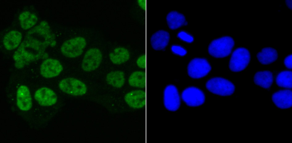IF(ICC) staining with MATR3 (7C4) Monoclonal Antibody (bsm-54243R) at 1:100 in Hela cells (green). The nuclear counterstain is DAPI (blue). Cells were fixed in paraformaldehyde, permeabilized with 0.25% Triton X100\/PBS.