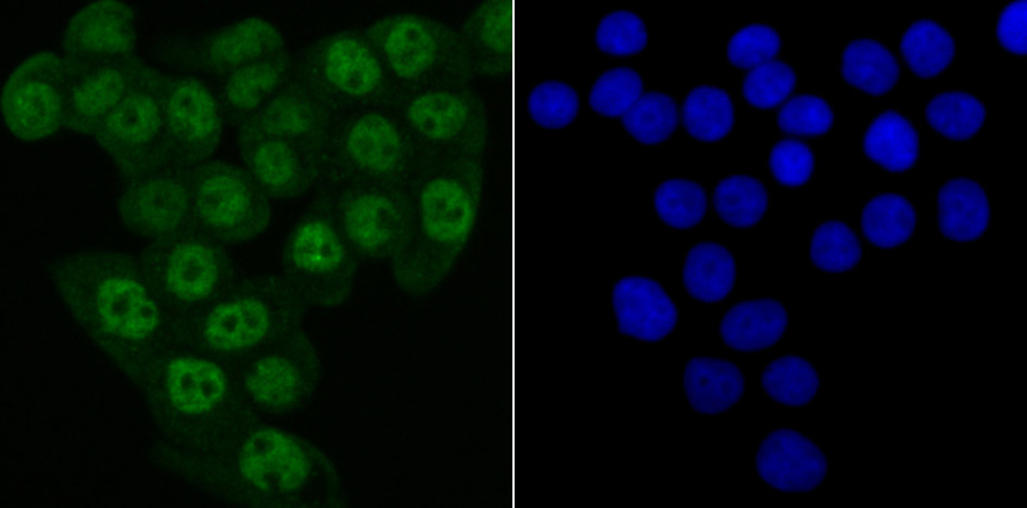 IF(ICC) staining with MATR3 (7C4) Monoclonal Antibody (bsm-54243R) at 1:100 in LOVO cells (green). The nuclear counterstain is DAPI (blue). Cells were fixed in paraformaldehyde, permeabilized with 0.25% Triton X100\/PBS.
