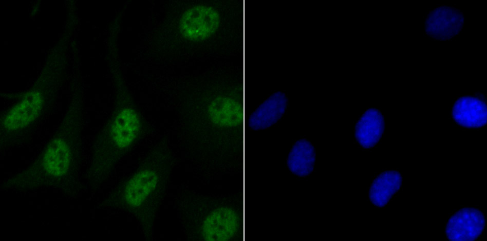 IF(ICC) staining with MATR3 (7C4) Monoclonal Antibody (bsm-54243R) at 1:100 in SH-SY5Y cells (green). The nuclear counterstain is DAPI (blue). Cells were fixed in paraformaldehyde, permeabilized with 0.25% Triton X100\/PBS.