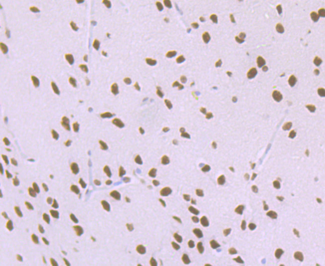 Paraformaldehyde-fixed and paraffin-embedded Rat Brain tissue incubated with MATR3 (7C4) Monoclonal Antibody (bsm-54243R) at 1:100, overnight at 4\u00b0C, followed by a conjugated secondary antibody and DAB staining. Counterstained with hematoxylin.