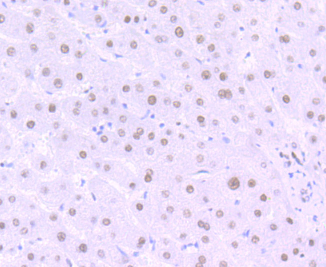 Paraformaldehyde-fixed and paraffin-embedded Human Liver tissue incubated with MATR3 (7C4) Monoclonal Antibody (bsm-54243R) at 1:100, overnight at 4\u00b0C, followed by a conjugated secondary antibody and DAB staining. Counterstained with hematoxylin.