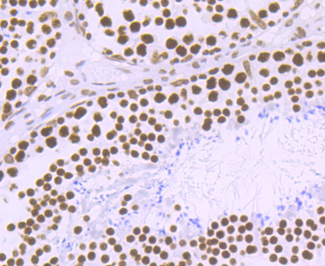 Paraformaldehyde-fixed and paraffin-embedded Mouse Testis tissue incubated with MATR3 (7C4) Monoclonal Antibody (bsm-54243R) at 1:100, overnight at 4\u00b0C, followed by a conjugated secondary antibody and DAB staining. Counterstained with hematoxylin.