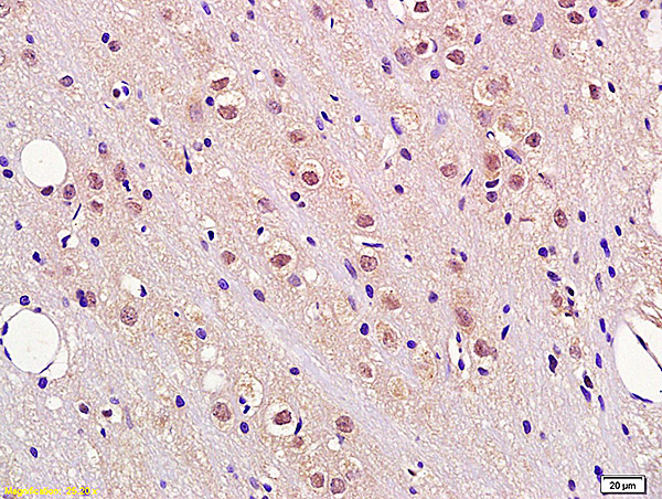 Formalin-fixed and paraffin embedded rat brain tissue labeled with Anti FBXW7/CDC4 Polyclonal Antibody, Unconjugated (bs-8394R) at 1:200 followed by conjugation to the secondary antibody and DAB staining.