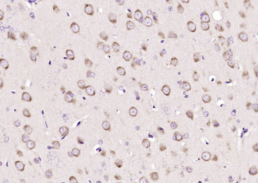 Paraformaldehyde-fixed, paraffin-embedded Rat brain; Antigen retrieval by boiling in sodium citrate buffer (pH6.0) for 15min; Block endogenous peroxidase by 3% hydrogen peroxide for 20 minutes; Blocking buffer (normal goat serum) at 37°C for 30min; Antibody incubation with Sema3F/semaphorin 3F Polyclonal Antibody, Unconjugated (bs-1122R) at 1:200 overnight at 4°C, DAB staining.