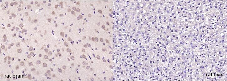 Positive sample：Paraformaldehyde-fixed, paraffin embedded (rat brian, left); Negative sample：Paraformaldehyde-fixed, paraffin embedded (rat liver, right);_x000D_ Antigen retrieval by boiling in sodium citrate buffer (pH6.0) for 15min; Block endogenous peroxidase by 3% hydrogen peroxide for 20 minutes; Blocking buffer (normal goat serum) at 37°C for 30min; Antibody incubation with (MOBP) Polyclonal Antibody, Unconjugated (bs-11184R) at 1:200 overnight at 4°C, followed by secondary antibody and DAB staining._x000D_