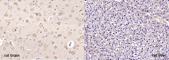 Positive sample：Paraformaldehyde-fixed, paraffin embedded (rat brian, left); Negative sample：Paraformaldehyde-fixed, paraffin embedded (rat liver, right); Antigen retrieval by boiling in sodium citrate buffer (pH6.0) for 15min; Block endogenous peroxidase by 3% hydrogen peroxide for 20 minutes; Blocking buffer (NG/Neurogranin) at 37°C for 30min; Antibody incubation with (HDAC4) Polyclonal Antibody, Unconjugated (bs-11435R) at 1:200 overnight at 4°C, followed by secondary antibody and DAB staining.