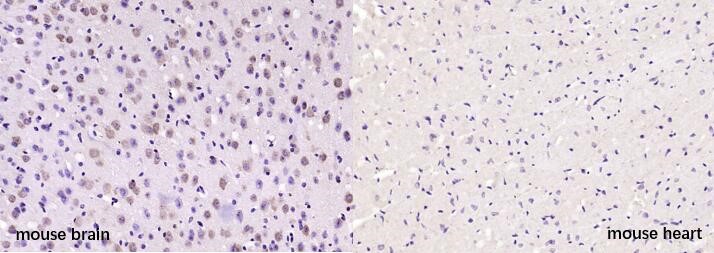 Positive sample：Paraformaldehyde-fixed, paraffin embedded (mouse brain, left); Negative sample：Paraformaldehyde-fixed, paraffin embedded (mouse heart, right); Antigen retrieval by boiling in sodium citrate buffer (pH6.0) for 15min; Block endogenous peroxidase by 3% hydrogen peroxide for 20 minutes; Blocking buffer (NG/Neurogranin) at 37°C for 30min; Antibody incubation with (HDAC4) Polyclonal Antibody, Unconjugated (bs-11435R) at 1:200 overnight at 4°C, followed by secondary antibody and DAB staining.