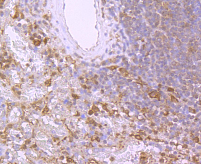 Paraformaldehyde-fixed and paraffin-embedded Human spleen tissue incubated with Bid (9C9) Monoclonal Antibody (bsm-52967R) at 1:100, overnight at 4°C, followed by a conjugated secondary antibody and DAB staining. Counterstained with hematoxylin.