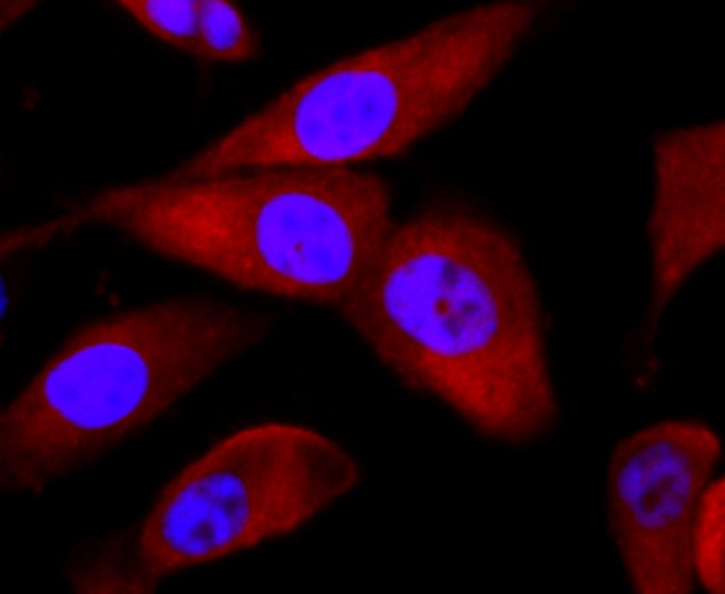 IF(ICC) staining with Bid (9C9) Monoclonal Antibody (bsm-52967R) at 1:100 in PC-3M cells (red). The nuclear counterstain is DAPI (blue). Cells were fixed in paraformaldehyde, permeabilized with 0.25% Triton X100/PBS.