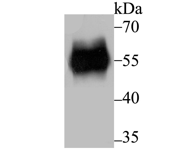 Lane 1: Human Colon; Probed with RBPJ (1D4) Monoclonal Antibody (bsm-54268R) at 1:500 overnight at 4°C followed by a conjugated secondary antibody for 60 minutes at 37°C. Lane 1: Human Colon; Probed with RBPJ (1D4) Monoclonal Antibody (bsm-54268R) at 1:500 overnight at 4°C followed by a conjugated secondary antibody for 60 minutes at 37°C.