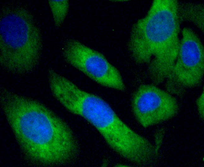 IF(ICC) staining with PHD1/prolyl hydroxylase (7G8) Monoclonal Antibody (bsm-52336R) at 1:100 in SKOV-3 cells (green). The nuclear counterstain is DAPI (blue). Cells were fixed in paraformaldehyde, permeabilized with 0.25% Triton X100/PBS.