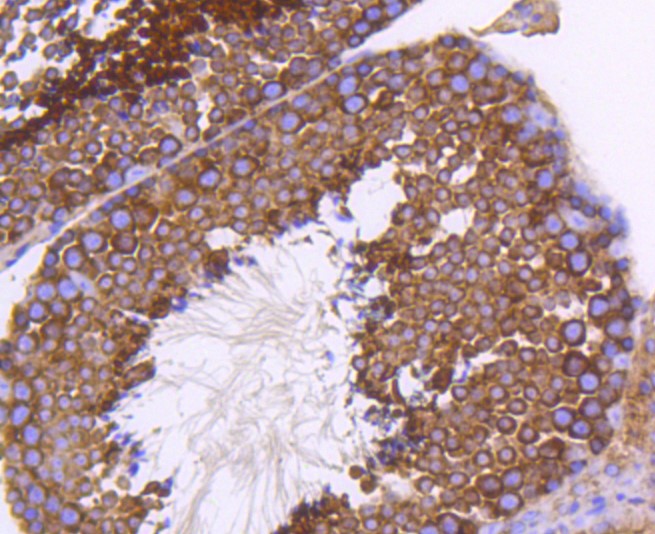Paraformaldehyde-fixed and paraffin-embedded Mouse testis tissue incubated with PHD1/prolyl hydroxylase (7G8) Monoclonal Antibody (bsm-52336R) at 1:100, overnight at 4°C, followed by a conjugated secondary antibody and DAB staining. Counterstained with hematoxylin.