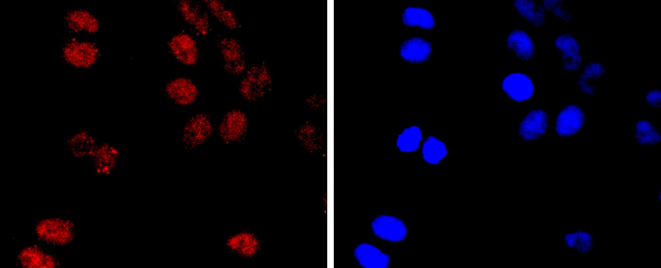 IF(ICC) staining with PMS2 (9H11) Monoclonal Antibody (bsm-52337R) at 1:100 in HeLa cells (red). The nuclear counterstain is DAPI (blue). Cells were fixed in paraformaldehyde, permeabilized with 0.25% Triton X100/PBS.