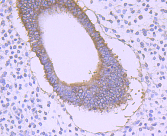 Paraformaldehyde-fixed and paraffin-embedded Human Uterine tissue incubated with GORASP1 (3G1) Monoclonal Antibody (bsm-54260R) at 1:100, overnight at 4°C, followed by a conjugated secondary antibody and DAB staining. Counterstained with hematoxylin.