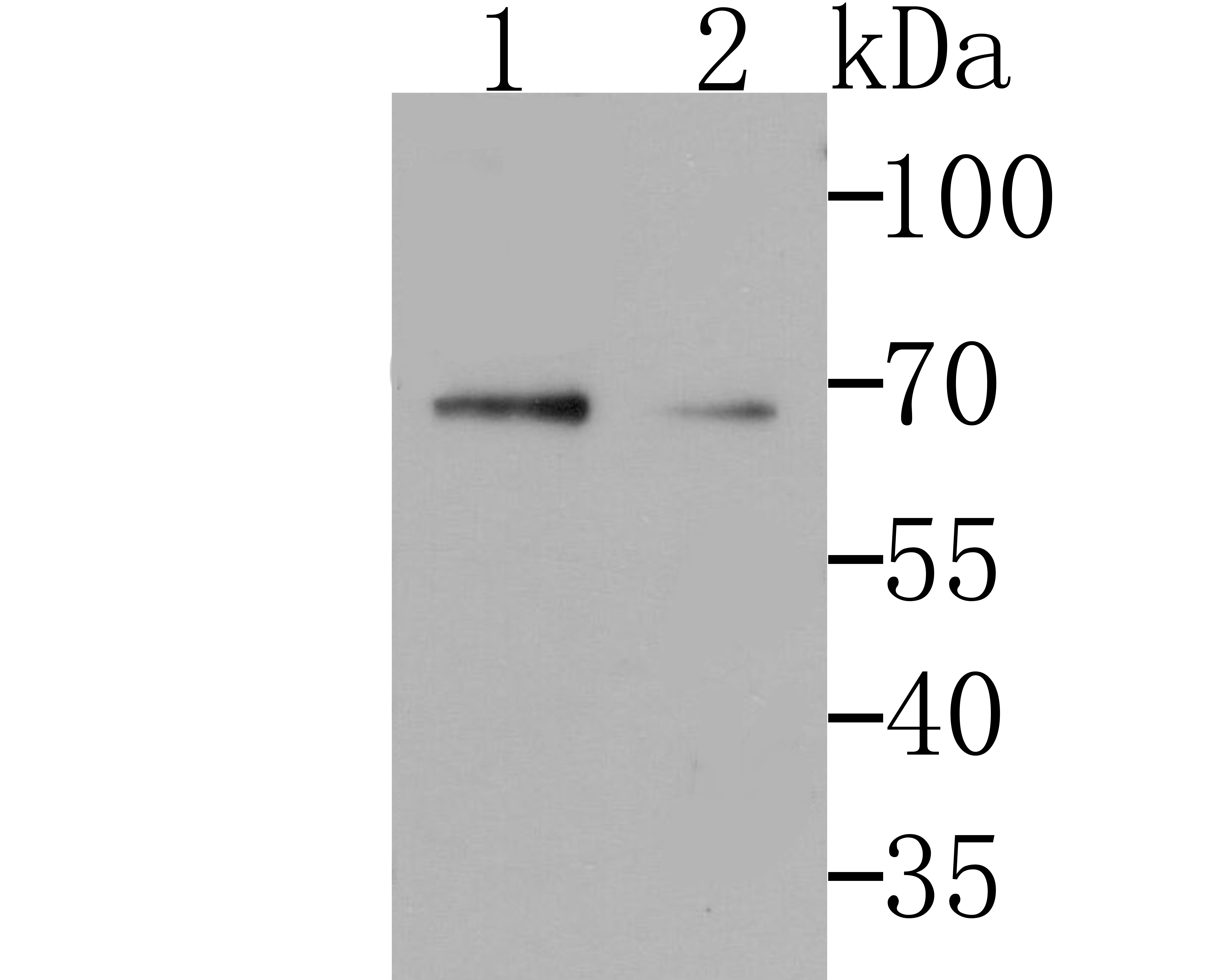 Lane 1: THP-1 Cells; Lane 2: SKBR3; Probed with GORASP1 (3G1) Monoclonal Antibody (bsm-54260R) at 1:500 overnight at 4°C followed by a conjugated secondary antibody for 60 minutes at 37°C.