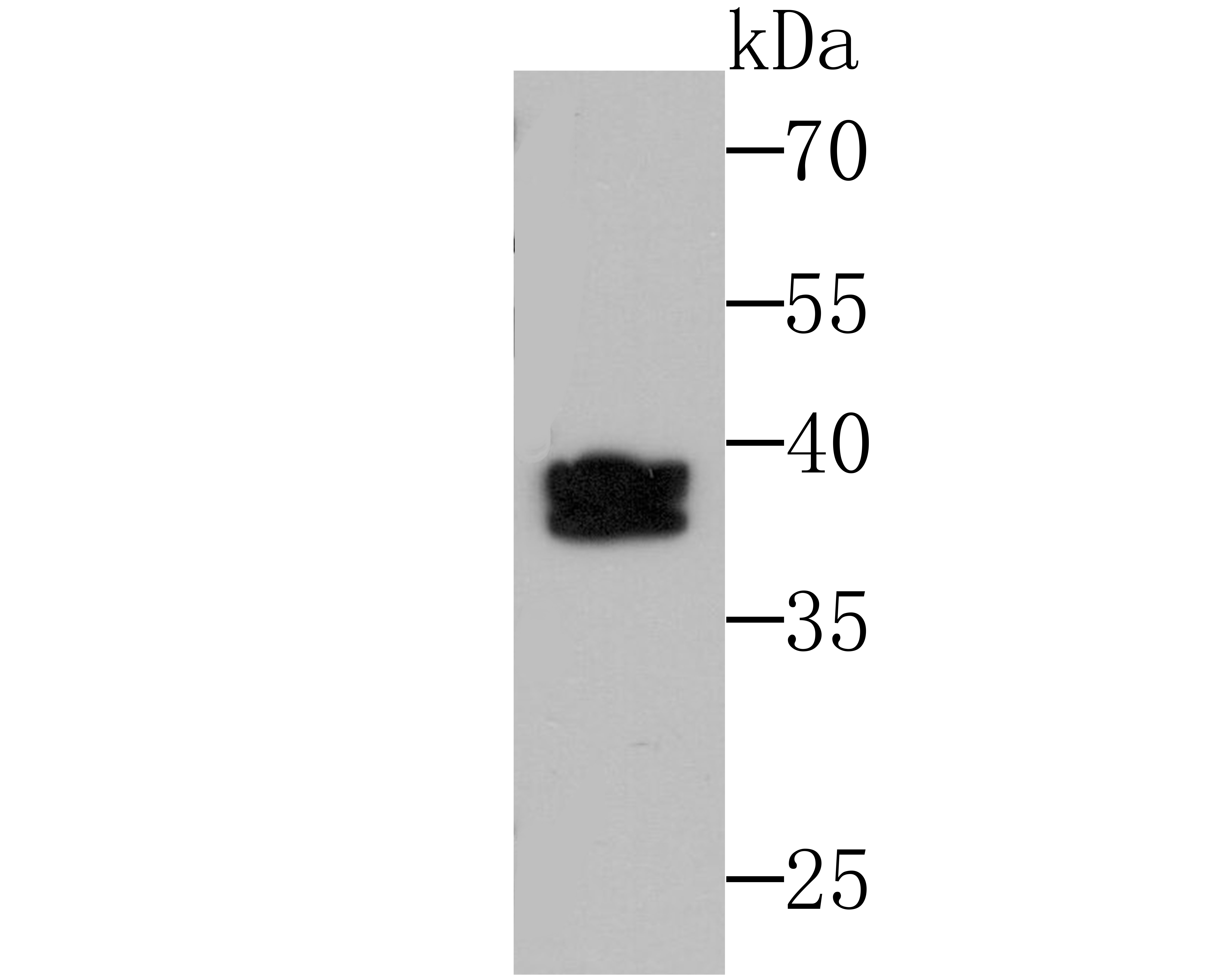Lane 1: K562 Cells; Probed with SET (2A1) Monoclonal Antibody (bsm-54264R) at 1:500 overnight at 4°C followed by a conjugated secondary antibody for 60 minutes at 37°C. Lane 1: K562 Cells; Probed with SET (2A1) Monoclonal Antibody (bsm-54264R) at 1:500 overnight at 4°C followed by a conjugated secondary antibody for 60 minutes at 37°C.