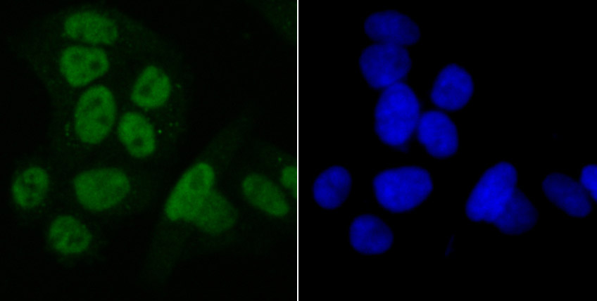 IF(ICC) staining with SET (2A1) Monoclonal Antibody (bsm-54264R) at 1:100 in Hela cells (green). The nuclear counterstain is DAPI (blue). Cells were fixed in paraformaldehyde, permeabilized with 0.25% Triton X100/PBS.