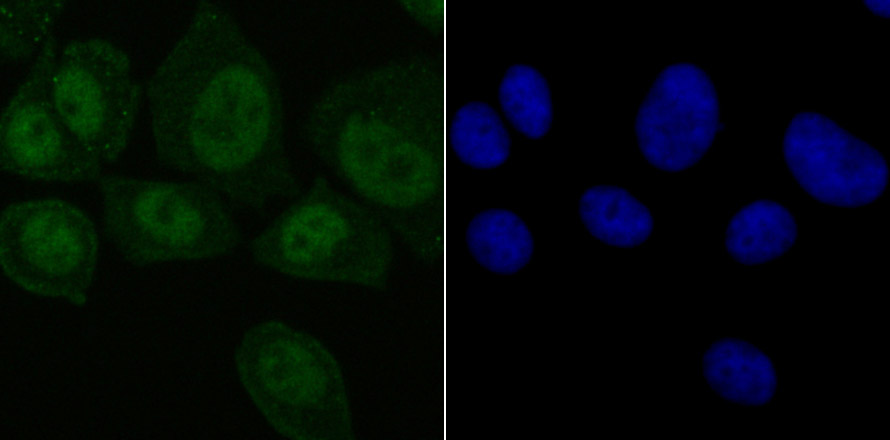 IF(ICC) staining with SET (2A1) Monoclonal Antibody (bsm-54264R) at 1:100 in MCF-7 cells (green). The nuclear counterstain is DAPI (blue). Cells were fixed in paraformaldehyde, permeabilized with 0.25% Triton X100/PBS.