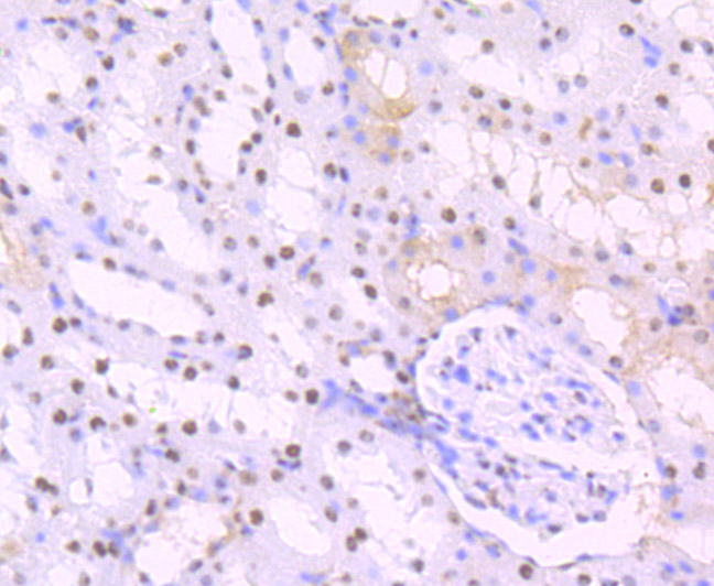 Paraformaldehyde-fixed and paraffin-embedded Rat Kidney tissue incubated with SET (2A1) Monoclonal Antibody (bsm-54264R) at 1:100, overnight at 4°C, followed by a conjugated secondary antibody and DAB staining. Counterstained with hematoxylin.