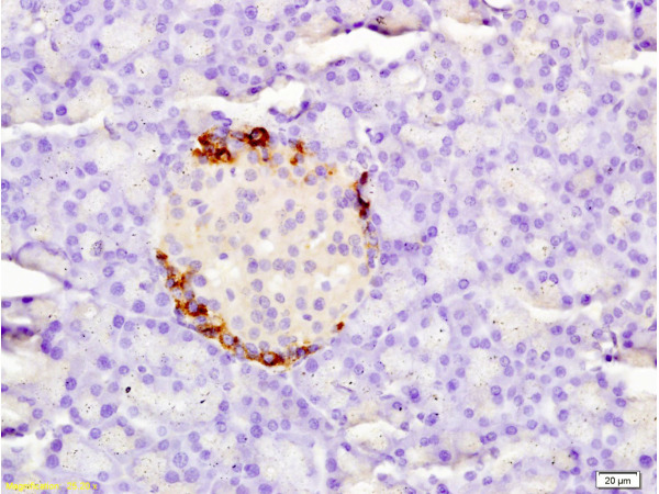 Formalin-fixed and paraffin embedded  rat pancreas labeled with Anti Tissue factor\/CD142\/F3 Polyclonal Antibody, Unconjugated (bs-4690RR) at 1:200 followed by conjugation to the secondary antibody and DAB staining.