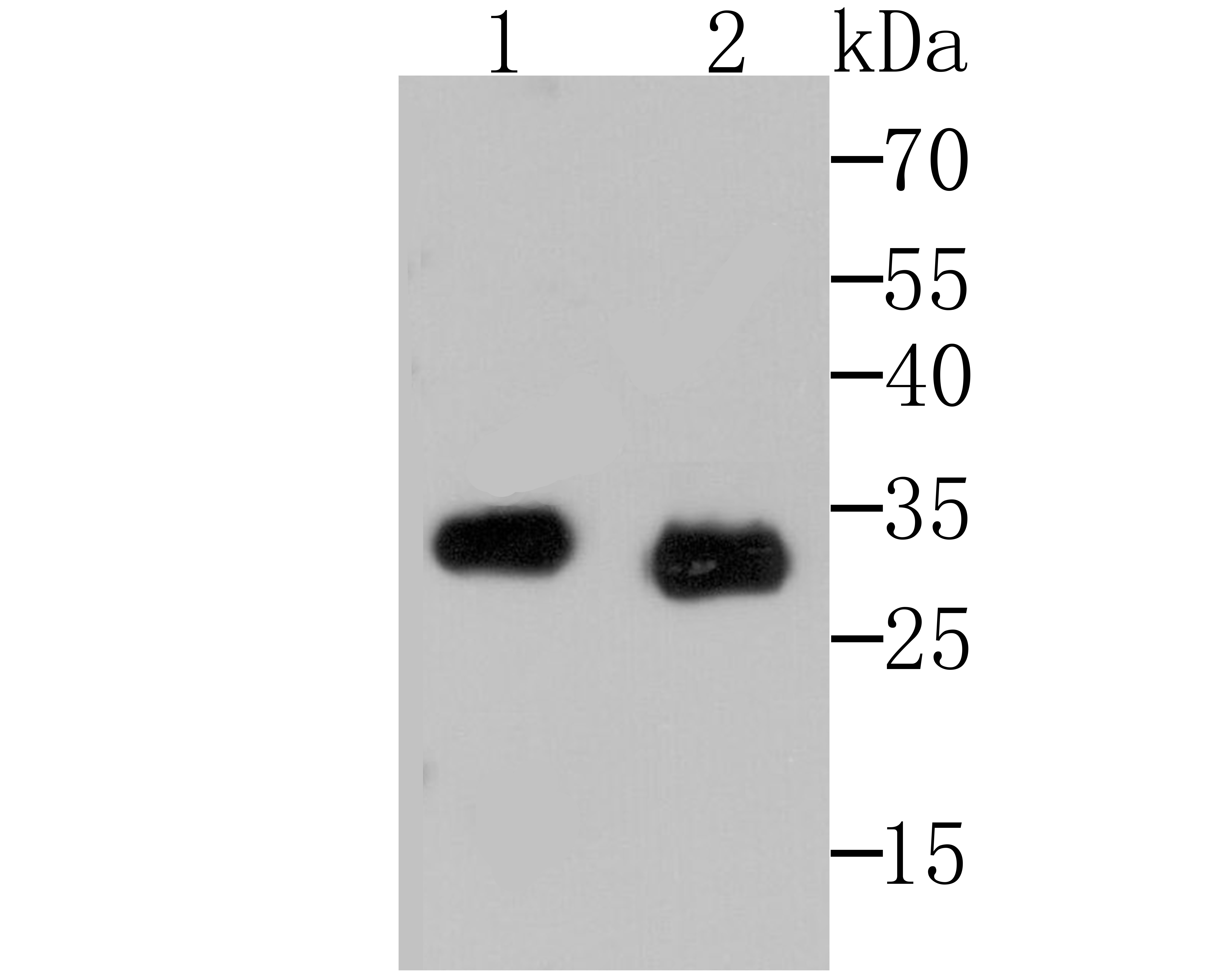 Lane 1: Rat Spleen; Lane 2: Mouse Spleen; Probed with Mast Cell Chymase (1G11) Monoclonal Antibody (bsm-54265R) at 1:500 overnight at 4°C followed by a conjugated secondary antibody for 60 minutes at 37°C.