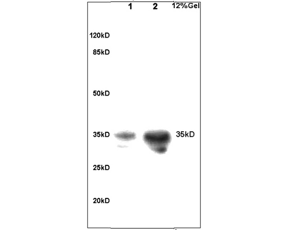 Lane 1: rat brain lysates Lane 2: rat liver lysates probed with Anti Tissue factor/CD142/F3 Polyclonal Antibody, Unconjugated (bs-4690R) at 1:200 overnight at 4˚C. Followed by conjugation to secondary antibody (bs-0295G-HRP) at 1:3000 for 90 min at 37˚C. Predicted band