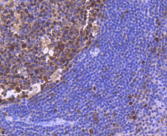 Paraformaldehyde-fixed and paraffin-embedded Human tonsil tissue incubated with PCNA (1G3) Monoclonal Antibody (bsm-52347R) at 1:300, overnight at 4\u00b0C, followed by a conjugated secondary antibody and DAB staining. Counterstained with hematoxylin.