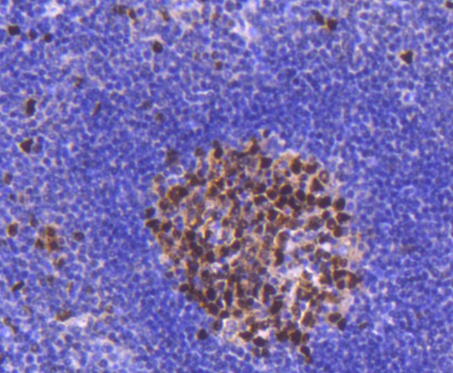 Paraformaldehyde-fixed and paraffin-embedded Human spleen tissue incubated with PCNA (1G3) Monoclonal Antibody (bsm-52347R) at 1:300, overnight at 4\u00b0C, followed by a conjugated secondary antibody and DAB staining. Counterstained with hematoxylin.