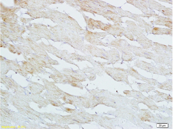 Formalin-fixed and paraffin embedded rat heart tissue labeled with Anti-HB EGF Polyclonal Antibody, Unconjugated (bs-3576R) at 1:200 followed by conjugation to the secondary antibody and DAB staining