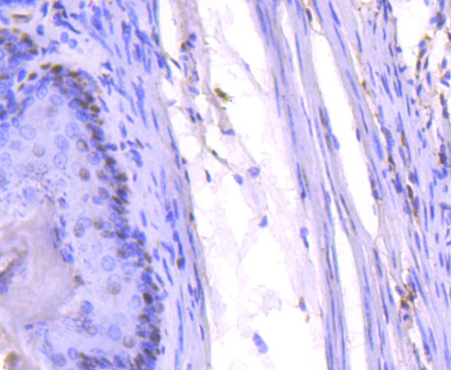 Paraformaldehyde-fixed and paraffin-embedded Mouse stomach tissue incubated with PCNA (1G3) Monoclonal Antibody (bsm-52347R) at 1:300, overnight at 4\u00b0C, followed by a conjugated secondary antibody and DAB staining. Counterstained with hematoxylin.