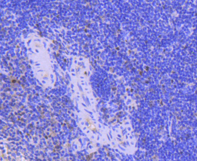 Paraformaldehyde-fixed and paraffin-embedded Mouse spleen tissue incubated with PCNA (1G3) Monoclonal Antibody (bsm-52347R) at 1:300, overnight at 4\u00b0C, followed by a conjugated secondary antibody and DAB staining. Counterstained with hematoxylin.