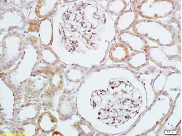 Formalin-fixed and paraffin embedded rat kidney labeled with Anti-HB EGF Polyclonal Antibody, Unconjugated (bs-3576R) at 1:200 followed by conjugation to the secondary antibody and DAB staining