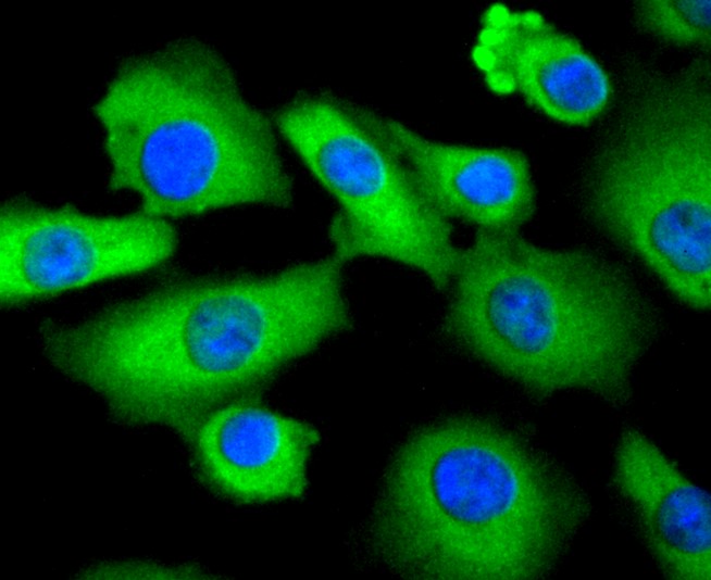 IF(ICC) staining with STAT3 (3F11) Monoclonal Antibody (bsm-52351R) at 1:300 in A549 cells (green). The nuclear counterstain is DAPI (blue). Cells were fixed in paraformaldehyde, permeabilized with 0.25% Triton X100/PBS.