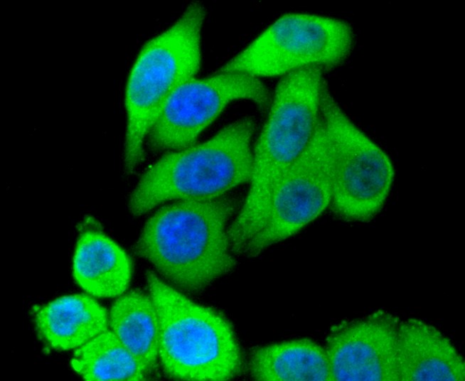 IF(ICC) staining with STAT3 (3F11) Monoclonal Antibody (bsm-52351R) at 1:300 in HepG2 cells (green). The nuclear counterstain is DAPI (blue). Cells were fixed in paraformaldehyde, permeabilized with 0.25% Triton X100/PBS.