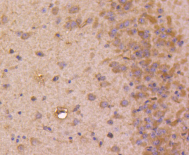 Paraformaldehyde-fixed and paraffin-embedded Mouse brain tissue incubated with STAT3 (3F11) Monoclonal Antibody (bsm-52351R) at 1:100, overnight at 4°C, followed by a conjugated secondary antibody and DAB staining. Counterstained with hematoxylin.