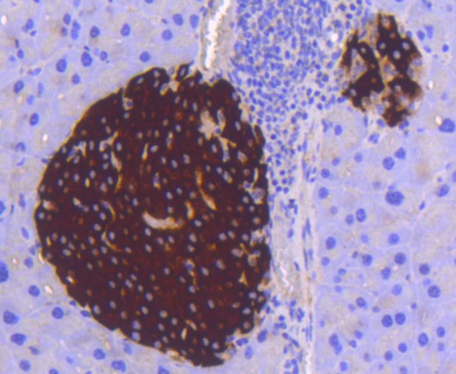 Paraformaldehyde-fixed and paraffin-embedded Mouse pancreas tissue incubated with STAT3 (3F11) Monoclonal Antibody (bsm-52351R) at 1:100, overnight at 4°C, followed by a conjugated secondary antibody and DAB staining. Counterstained with hematoxylin.