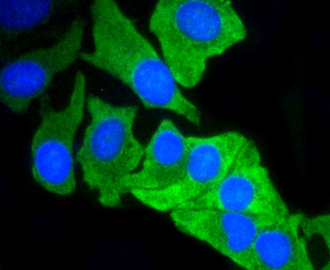 IF(ICC) staining with MCL1 (1A11) Monoclonal Antibody (bsm-52357R) at 1:100 in BT-20 cells (green). The nuclear counterstain is DAPI (blue). Cells were fixed in paraformaldehyde, permeabilized with 0.25% Triton X100/PBS.