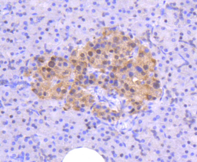 Paraformaldehyde-fixed and paraffin-embedded Human pancreas tissue incubated with ATM (12A) Monoclonal Antibody (bsm-52360R) at 1:100, overnight at 4°C, followed by a conjugated secondary antibody and DAB staining. Counterstained with hematoxylin.