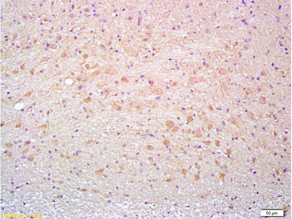 Formalin-fixed and paraffin embedded rat brain tissue labeled with Anti-Thy-1\/CD90\/ Thy1.1 Polyclonal Antibody, Unconjugated (bs-0778R) at 1:200, followed by conjugation to the secondary antibody and DAB staining