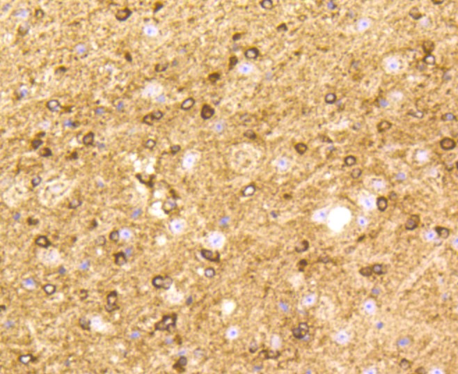 Paraformaldehyde-fixed and paraffin-embedded Mouse brain tissue incubated with BDNF (2A1) Monoclonal Antibody (bsm-52368R) at 1:100, overnight at 4\u00b0C, followed by a conjugated secondary antibody and DAB staining. Counterstained with hematoxylin.