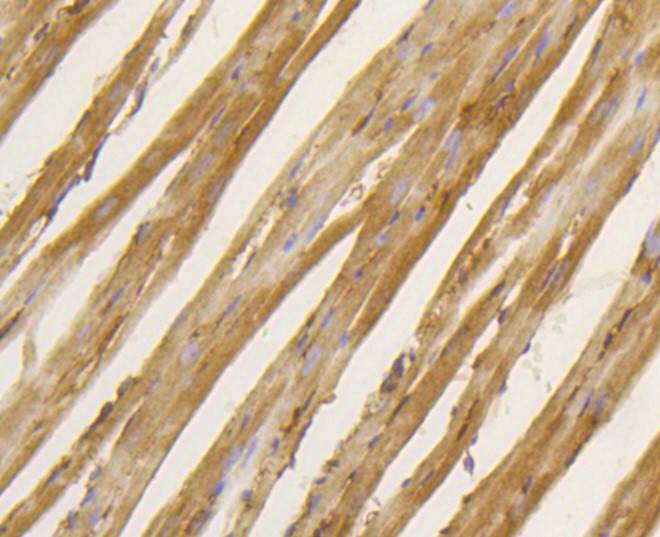 Paraformaldehyde-fixed and paraffin-embedded Mouse heart tissue incubated with BDNF (2A1) Monoclonal Antibody (bsm-52368R) at 1:100, overnight at 4\u00b0C, followed by a conjugated secondary antibody and DAB staining. Counterstained with hematoxylin.