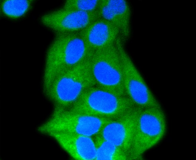 LDL Receptor Recombinant Antibody – Bioss